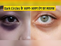 आंखों के नीचे नीले या ब्राउन घेरे क्यों हो जाते हैं? न्यूट्रिशनिस्ट ने बताया Dark Circles के अलग-अलग रंग का मतलब आंखों के नीचे नीले या ब्राउन घेरे क्यों हो जाते हैं? न्यूट्रिशनिस्ट ने बताया Dark Circles के अलग-अलग रंग का मतलब