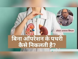 कब कराना चाहिए पथरी का ऑपरेशन, बिना ऑपरेशन के पथरी कैसे निकलती है? कब कराना चाहिए पथरी का ऑपरेशन, बिना ऑपरेशन के पथरी कैसे निकलती है?