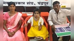 अवघी 2 फूट 3 इंच उंची! जगातली दुसऱ्या क्रमांकाची ठेंगणी मुलगी सापडली, 'या' जिल्ह्यात आहे तिचं वास्तव्य