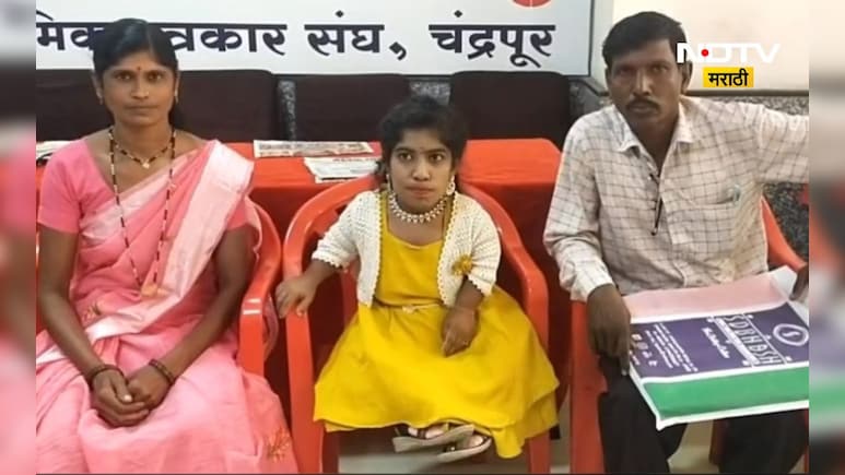 अवघी 2 फूट 3 इंच उंची! जगातली दुसऱ्या क्रमांकाची ठेंगणी मुलगी सापडली, 'या' जिल्ह्यात आहे तिचं वास्तव्य