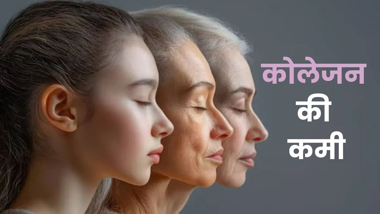 कोलेजन की कमी के ये हैं लक्षण, खाइए ये चीजें 15 दिन में आप भी दिखने लगेंगी 20 साल की कोलेजन की कमी के ये हैं लक्षण, खाइए ये चीजें 15 दिन में आप भी दिखने लगेंगी 20 साल की
