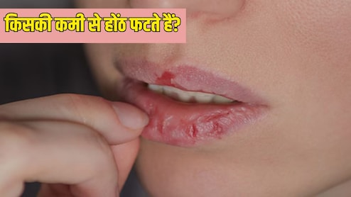 किस विटामिन की कमी से होंठ फटते हैं?