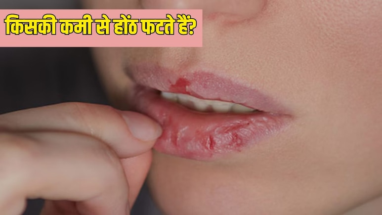किस विटामिन की कमी से होंठ फटते हैं?