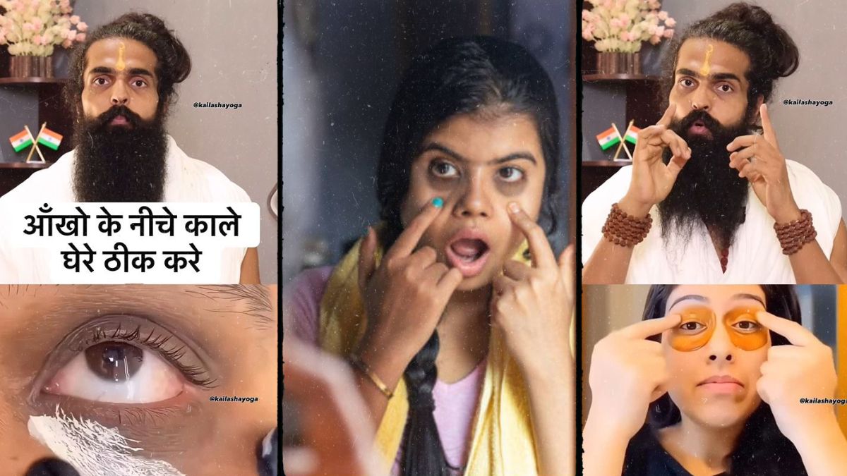 डार्क सर्कल ने बिगाड़ दी आपके चेहरे की खूबसूरती? ये लगाते ही 2 बार में गायब होंगे आंखों के नीचे बने गड्ढे