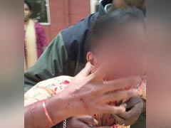 Dog Bites Woman On Face As She Steps Out Of Washroom In Karnataka Court