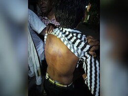 200 रुपये चुराने का शक, सीनियर छात्रों ने जूनियर को बेल्ट और पाइप से बुरी तरह पीटा, FIR दर्ज