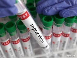 First Case Of New Mpox Variant Detected In Netherlands