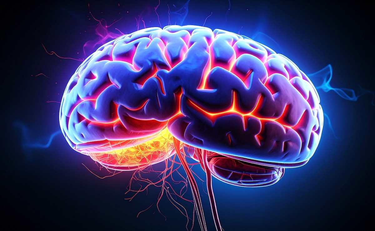 Study Reveals Independent Role Of Alzheimers Gene In Triggering Delirium