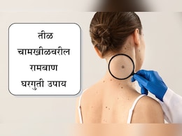 Beauty Tips: चेहऱ्यावरील तीळ-चामखीळमुळे हैराण आहात? करा हे घरगुती उपाय, चेहऱ्यावरही येईल तेज