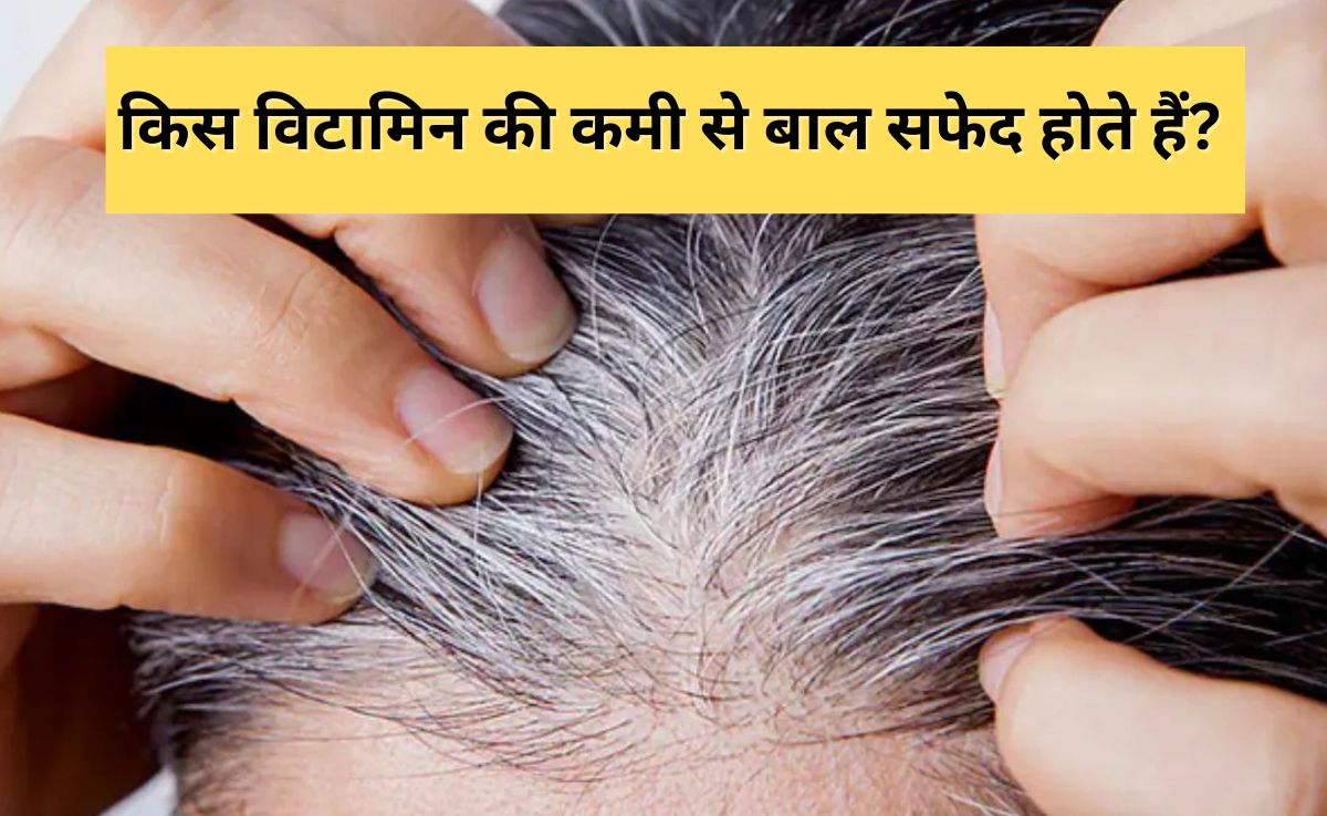 बालों को सफेद बना देती है इस विटामिन की कमी, जानिए क्या खाने पर बाल हो जाएंगे काले