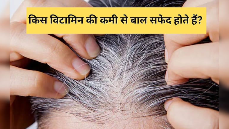 बालों को सफेद बना देती है इस विटामिन की कमी, जानिए क्या खाने पर बाल हो जाएंगे काले बालों को सफेद बना देती है इस विटामिन की कमी, जानिए क्या खाने पर बाल हो जाएंगे काले