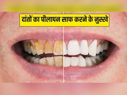 पीले दांतों को सफेद करने के 5 असरदार नुस्खे, कुछ ही दिनों में दिखने लगेगा असर पीले दांतों को सफेद करने के 5 असरदार नुस्खे, कुछ ही दिनों में दिखने लगेगा असर