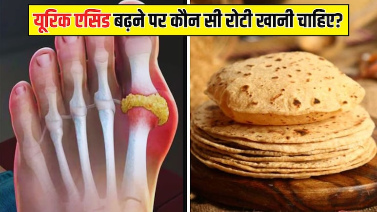यूरिक एसिड में कौन सा आटा खाना चाहिए? आयुर्वेदिक डॉक्टर ने बताया इस रोटी से पिघल जाएंगे प्यूरीन के पत्थर