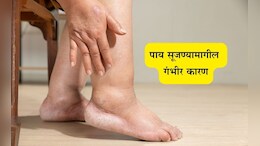 Swollen Legs and Ankles Problems: पायांना सूज येतेय? शरीरामध्ये निर्माण झालीय या महत्त्वपूर्ण गोष्टीची कमतरता