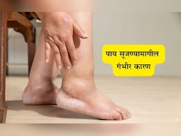 Swollen Legs and Ankles Problems: पायांना सूज येतेय? शरीरामध्ये निर्माण झालीय या महत्त्वपूर्ण गोष्टीची कमतरता Swollen Legs and Ankles Problems: पायांना सूज येतेय? शरीरामध्ये निर्माण झालीय या महत्त्वपूर्ण गोष्टीची कमतरता