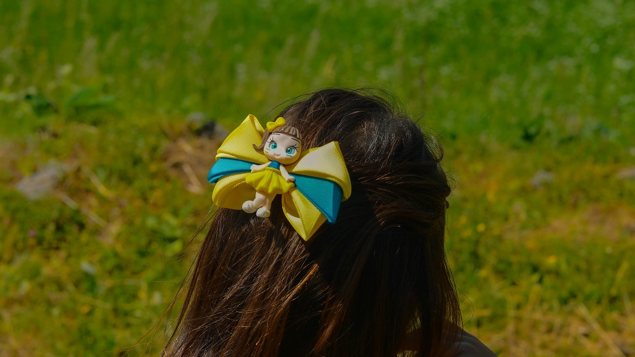 How To Reduce Hairfall: Scrunchies To Clips, Hair Accessories That Help