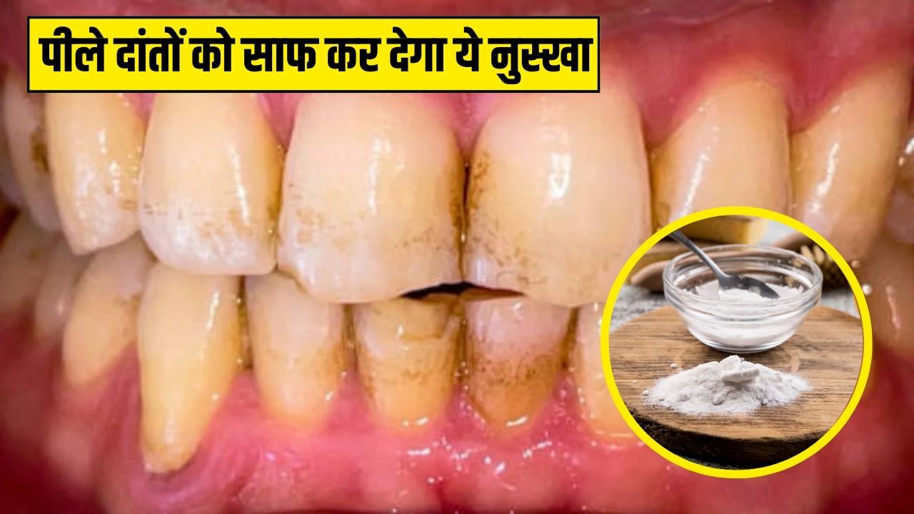 रात को सोने से पहले दांतों पर एक चुटकी लगा लें ये चीज, आयुर्वेदिक डॉक्टर ने बताया साफ हो जाएगा पीलापन, सफेद चमकदार दिखेंगे Teeth