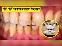 रात को सोने से पहले दांतों पर एक चुटकी लगा लें ये चीज, आयुर्वेदिक डॉक्टर ने बताया साफ हो जाएगा पीलापन, सफेद चमकदार दिखेंगे Teeth रात को सोने से पहले दांतों पर एक चुटकी लगा लें ये चीज, आयुर्वेदिक डॉक्टर ने बताया साफ हो जाएगा पीलापन, सफेद चमकदार दिखेंगे Teeth