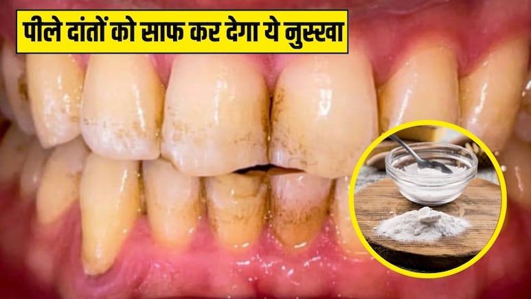 रात को सोने से पहले दांतों पर एक चुटकी लगा लें ये चीज, आयुर्वेदिक डॉक्टर ने बताया साफ हो जाएगा पीलापन, सफेद चमकदार दिखेंगे Teeth रात को सोने से पहले दांतों पर एक चुटकी लगा लें ये चीज, आयुर्वेदिक डॉक्टर ने बताया साफ हो जाएगा पीलापन, सफेद चमकदार दिखेंगे Teeth