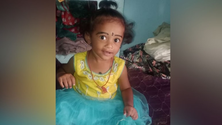 Toddler Dies After Falling Into Pot Of Boiling Milk In Andhra