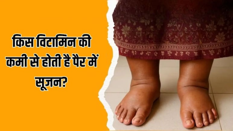 पैर में सूजन किस विटामिन की कमी से होती है?