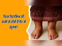 पैर में सूजन किस विटामिन की कमी से होती है? पैर में सूजन किस विटामिन की कमी से होती है?