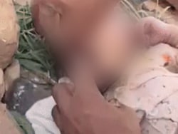 Lips Sealed With Glue, Stone Inside Mouth, Newborn Found Abandoned In Rajasthan Forest