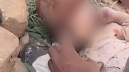 Lips Sealed With Glue, Stone Inside Mouth, Newborn Found Abandoned In Rajasthan Forest