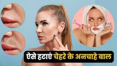 चेहरे पर उगे अनचाहे बालों को खत्म करने के लिए बस पानी में मिलाकर पी लो सिर्फ 1 चीज