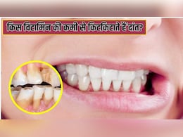 किस विटामिन की कमी से दांत पीसने लगते हैं? किस विटामिन की कमी से दांत पीसने लगते हैं?