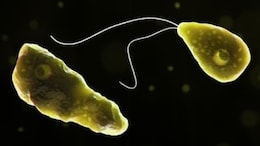 Brain Fever: Karnataka Government Releases Guidelines For Prevention Of 'Brain-Eating Amoeba' Cases