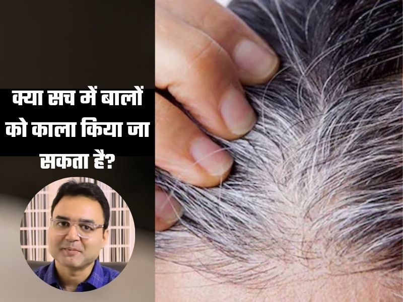 बाल सफेद क्यों होते हैं, क्या इन्हें परमानेंट काला किया जा सकता है? डॉक्टर ने बताया ऐसा नुस्खा फिर कभी नहीं लगानी पड़ेगी मेंहदी और डाई