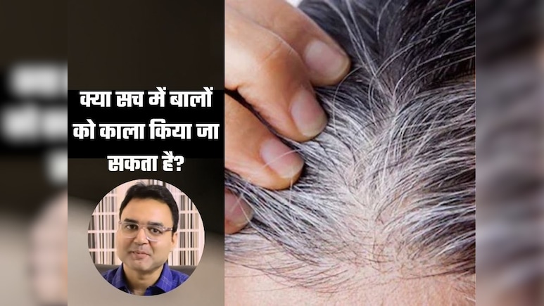 बाल सफेद क्यों होते हैं, क्या इन्हें परमानेंट काला किया जा सकता है? डॉक्टर ने बताया ऐसा नुस्खा फिर कभी नहीं लगानी पड़ेगी मेंहदी और डाई