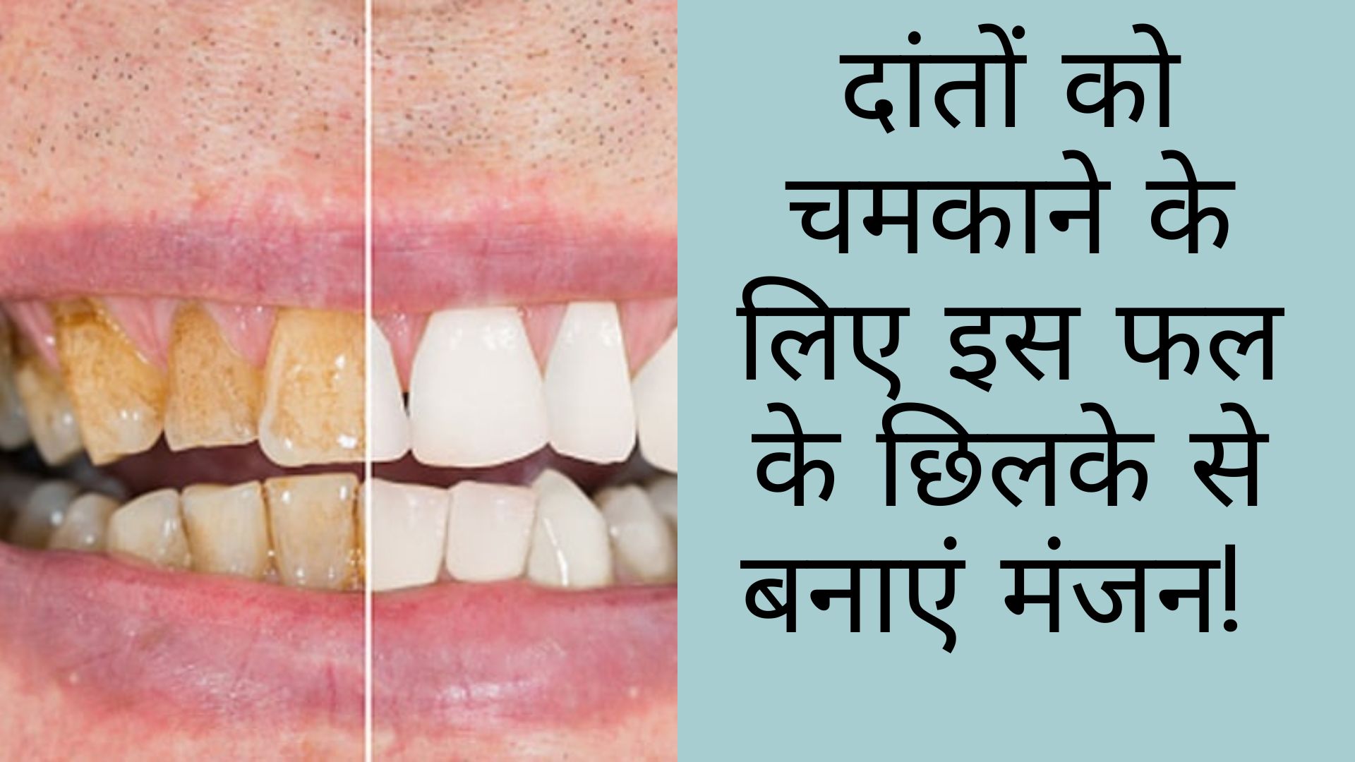दांतों की गंदगी को झट से साफ कर देगा ये फल, बस इस तरह से करें इस्तेमाल, दूध से चमकेंगे पीले दांत