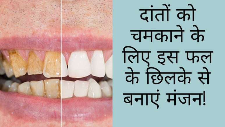 दांतों की गंदगी को झट से साफ कर देगा ये फल, बस इस तरह से करें इस्तेमाल, दूध से चमकेंगे पीले दांत
