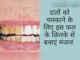 दांतों की गंदगी को झट से साफ कर देगा ये फल, बस इस तरह से करें इस्तेमाल, दूध से चमकेंगे पीले दांत दांतों की गंदगी को झट से साफ कर देगा ये फल, बस इस तरह से करें इस्तेमाल, दूध से चमकेंगे पीले दांत