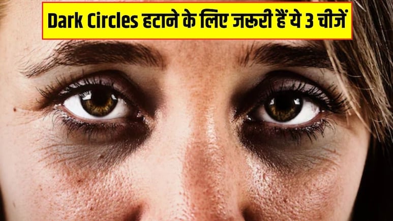 Dark Circles कम करने के लिए जरूरी हैं ये 3 चीजें, न्यूट्रिशनिस्ट ने बताया आंखों के नीचे के काले घेरों को हमेशा के लिए कैसे हटाएं