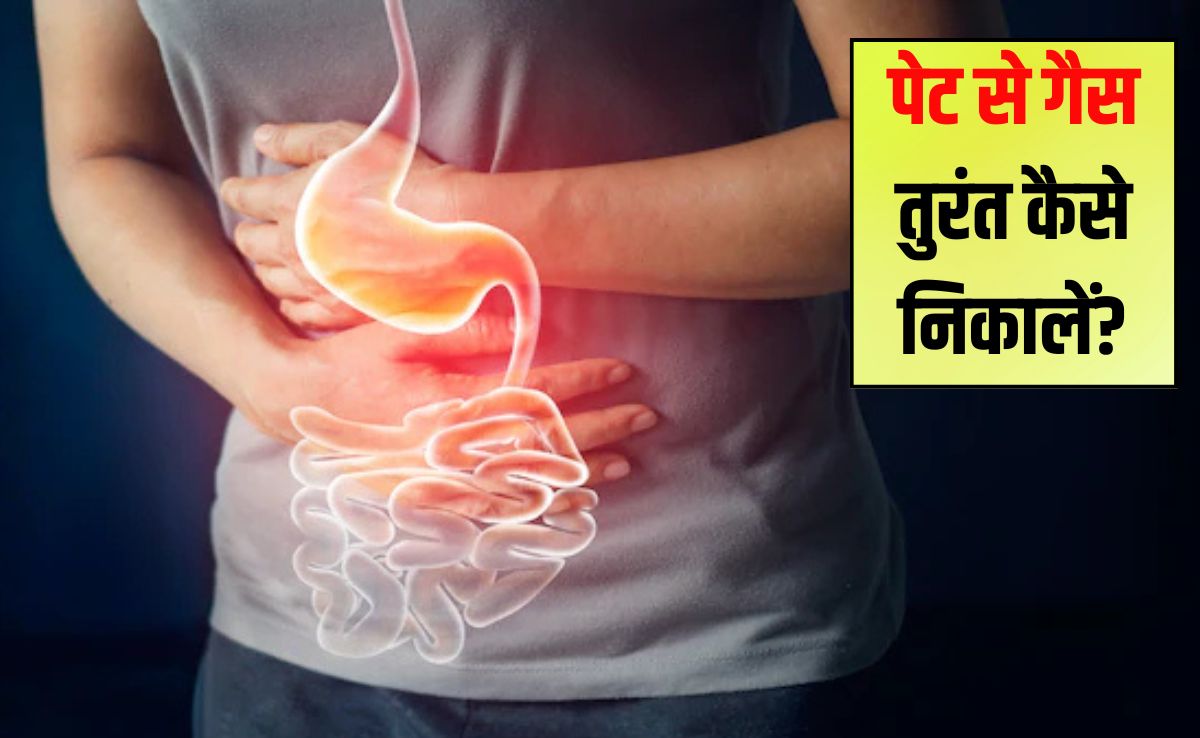 पेट की गैस को तुरंत कैसे निकालें?  पेट में गैस होने पर कौन सा पॉइंट दबाए, जान‍िए यहां