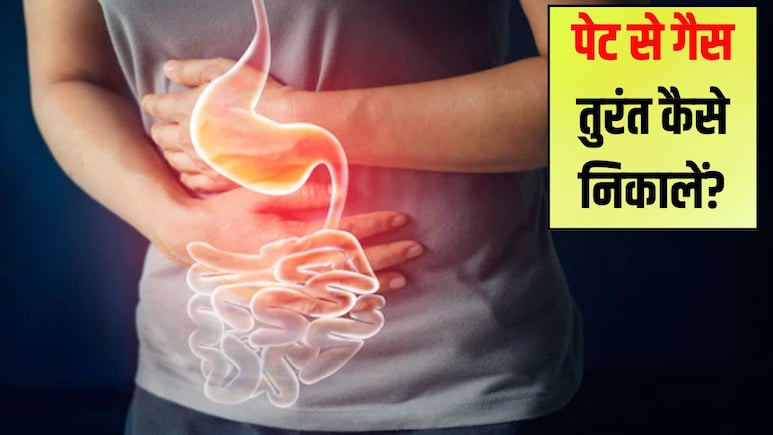 पेट की गैस को तुरंत कैसे निकालें? पेट में गैस हो तो क्या नहीं खाना चाहिए, जान‍िए यहां