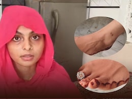 महिला को 6 महीने में जहरीले सांप ने 7 बार काटा... हर बार ICU से मौत को दी मात, अब डर के साए में पति महिला को 6 महीने में जहरीले सांप ने 7 बार काटा... हर बार ICU से मौत को दी मात, अब डर के साए में पति