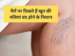 खून की नलियां होने लगती हैं बंद तो पैरों पर दिखते हैं ये 6 शुरुआती लक्षण, डॉक्टर ने बताया कैसे पहचानें खून की नलियां होने लगती हैं बंद तो पैरों पर दिखते हैं ये 6 शुरुआती लक्षण, डॉक्टर ने बताया कैसे पहचानें