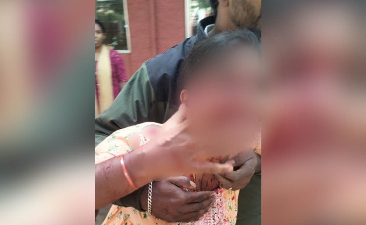 Dog Bites Woman On Face As She Steps Out Of Washroom In Karnataka Court
