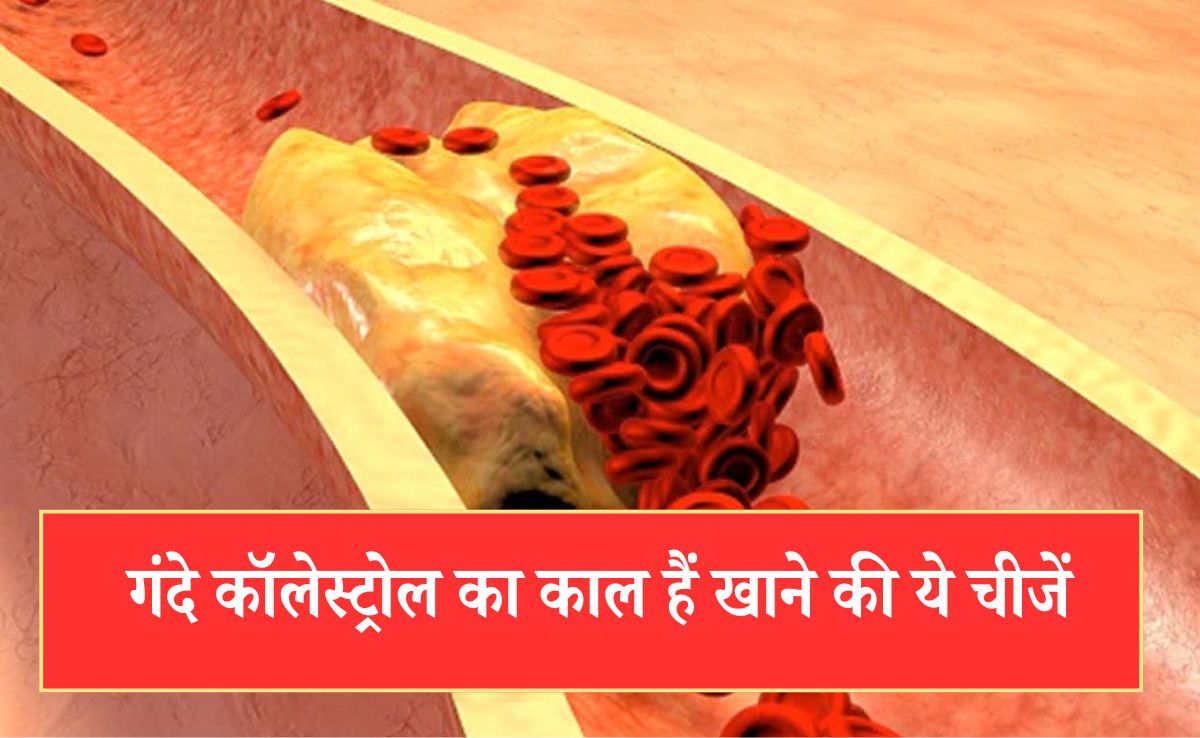 High Cholesterol को कम करने के लिए क्या खाना चाहिए? डॉक्टर ने बताई ऐसी 5 देसी चीजें जो घटा देती हैं गंदे कॉलेस्ट्रोल की मात्रा