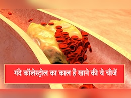 High Cholesterol को कम करने के लिए क्या खाना चाहिए? डॉक्टर ने बताई ऐसी 5 देसी चीजें जो घटा देती हैं गंदे कॉलेस्ट्रोल की मात्रा