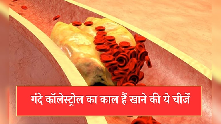 High Cholesterol को कम करने के लिए क्या खाना चाहिए? डॉक्टर ने बताई ऐसी 5 देसी चीजें जो घटा देती हैं गंदे कॉलेस्ट्रोल की मात्रा
