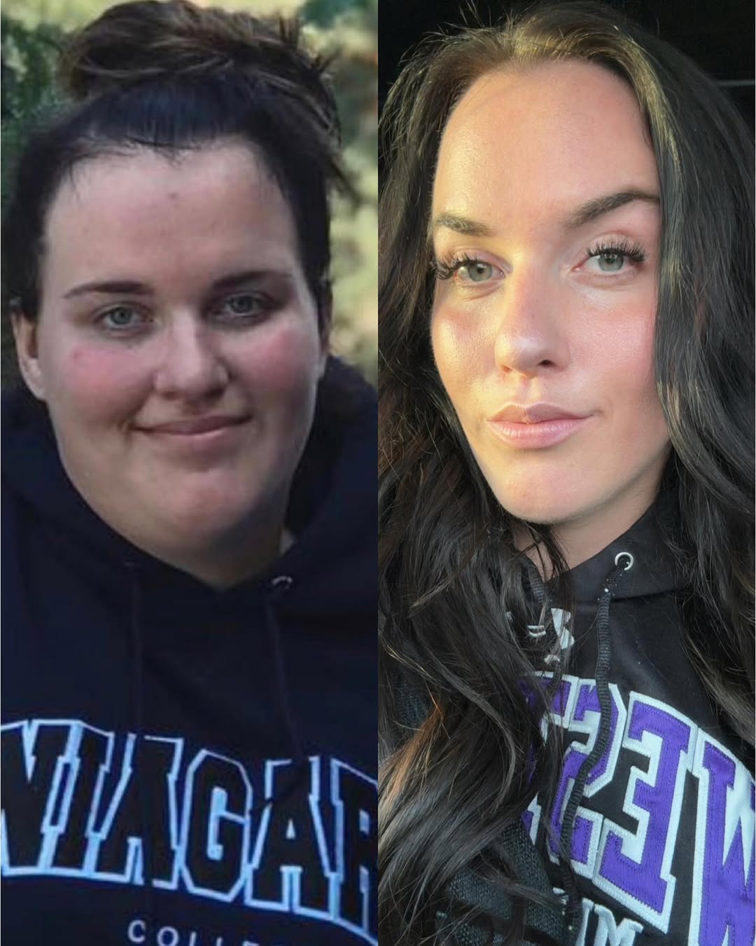 Woman Who Lost 72 kg While Battling ADHD And An Eating Disorder Shares Her Weight Loss Journey