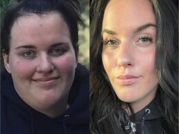 Woman Who Lost 72 Kg While Battling ADHD And An Eating Disorder Shares Her Weight Loss Journey