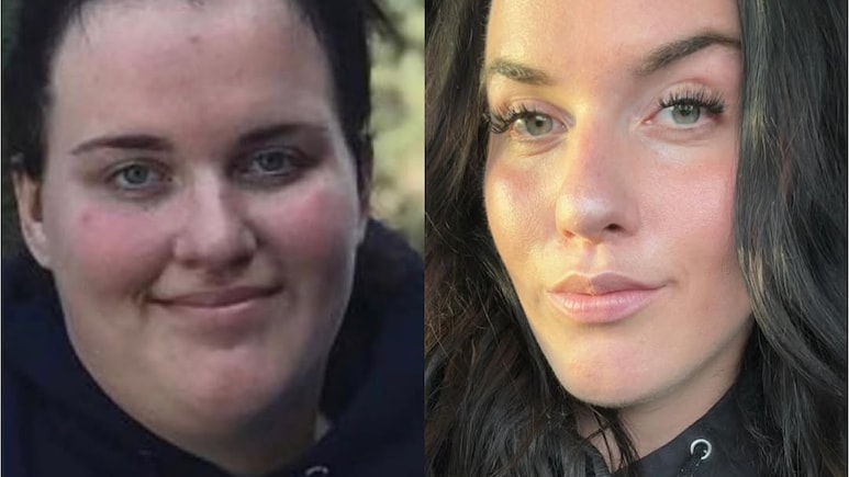 Woman Who Lost 72 Kg While Battling ADHD And An Eating Disorder Shares Her Weight Loss Journey Woman Who Lost 72 Kg While Battling ADHD And An Eating Disorder Shares Her Weight Loss Journey
