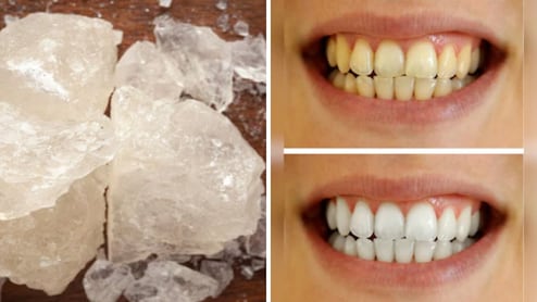 Turati Benefits For Teeth: दातांचा पिवळेपणा या पांढऱ्या दगडाने होईल दूर? कसा करायचा वापर, वाचा माहिती