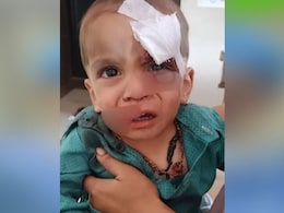 Rajasthan: उदयपुर में आवारा कुत्तों का आतंक, बच्चे के होंठ नोंचे, आंख जख्मी होते-होते बची Rajasthan: उदयपुर में आवारा कुत्तों का आतंक, बच्चे के होंठ नोंचे, आंख जख्मी होते-होते बची